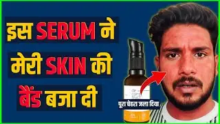 Deconstruct Vitamin C Serum burned my skin 😱