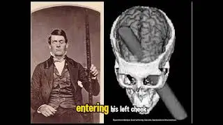 The Curious Case of Phineas Gage
