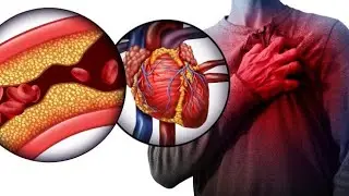 PRT 1: OKULWANYISA PRESSURE - KILL 100 DISEASES WITH FOOD #C24/7 #Choleduz #Restorlyf