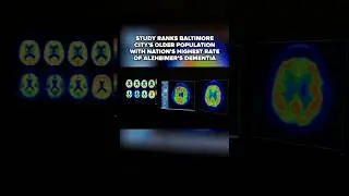 Study ranks Baltimore City with nation&rsquo;s highest rate of Alzheimer&rsquo;s