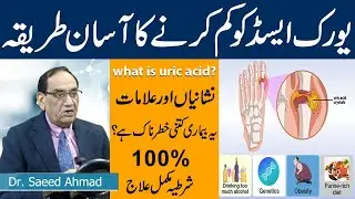 What is uric acid? Uric Acid Ka ilaj | Gout Ka Ilaj | Causes, Symptoms & Treatment | Dr Saeed Ahmed