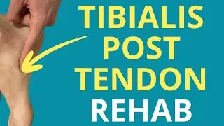 5 Exercises for Tibialis Posterior Tendinopathy