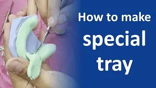 How to make special tray by Dr Mahmoud Zahw