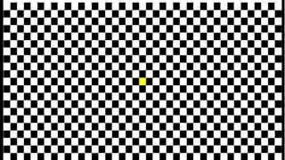 Visual Evoked Potential (VEP) - can also uncover scotomas.wmv