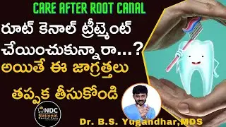 రూట్‌ కెనాల్‌ తర్వాత ఈ జాగ్రత్తలు తప్పనిసరి || Precautions After Root Canal || Dr Yugandhar ||  NDC