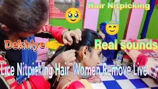 Nit Picking Hair Combing And Lice Romove New Video