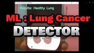 Pictoblox: ML : Lung Cancer Detector | Python Coding