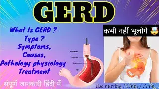 MSN-1 GERD { Gastroesophageal Reflux Disease } Complete Explain In Hindi #bscnursing #mbbs #gerd