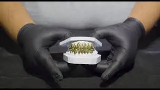 10KT Gold 10 on 10 Grillz w/ Perm Cuts &ndash; Custom Fit & Shine | NdacuttGrillz.com