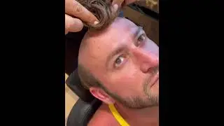 Peruca bărbați , înainte și după