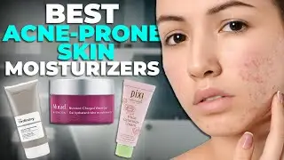 Top 3 Face Moisturizers For Acne-Prone Skin 2021