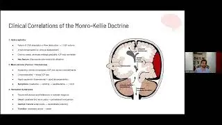 Cerebral Autoregulation, Monro-Kellie Doctrine & ICP Monitoring