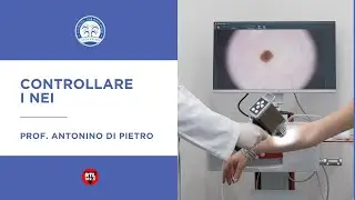 Controllare i nei