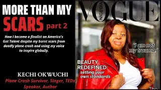 MORE THAN MY SCARS👉Part 2 Kechi Okwuchi's story...road to fame despite tragedy of deadly plane crash
