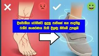 දියවැඩියා රෝගීන්ට සුදුසු පාවහන් සහ පාදවල රුධිර සංසරණය වැඩි දියුණු කිරීමේ උපක්‍රම