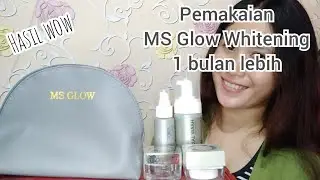 Sharing Pemakaian MS Glow Whitening | Skincare Pencerah Wajah