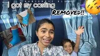 Finally I got rid of my casting 🥳!!#hanishree_vlogs #legfracture #kannadavlogger #youtuber 