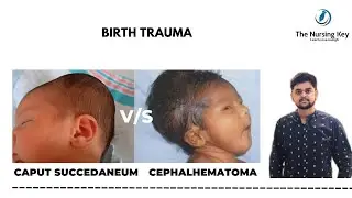 Caput Succedaneum Vs Cephalhematoma | Pediatric Nursing | Shivam Mandal | The Nursing Key