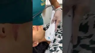 Hifu facial  | Cl&iacute;nica Gulfo