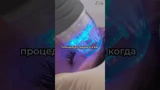 ТОП 3 весенних процедур в косметологии. 3 Микроигольчатый РФ. Вищипанова Н.Л.