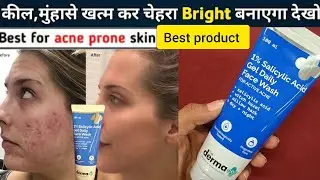 The Derma Co Salicylic Acid Face Wash | the derma co salicylic acid gel face wash | best face wash