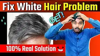 16 साल मे बाल सफेद होना कैसे रोकें | How to Fix white Hair problem in Young Age | Fix Hair Problem.