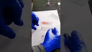 Blood smear preparation || how to make perfect smear #shortsfeed #shortsvideo