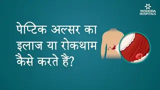 How do you treat or prevent peptic ulcers?