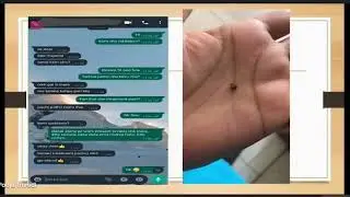 stone & its Homoeopathic managment by dr anjli shah and dr jaymin trivedi