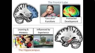 Charting the impacts of SES disadvantage: Bridging brain, behavior, and mental health, Jamie Hanson
