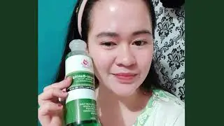 ✅Beauty Obsessions Miracle Toner Tawas-Calamansi -Baking Soda