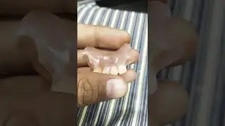 Lower Interior 4 Unit Flexible Removable Partial Denture By Haider 😁😁😁#flexible#partialdenture#short