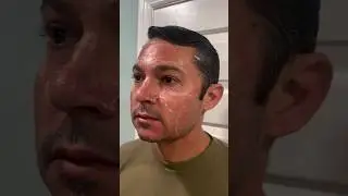 Tune in for the day-by-day #VIPeel process! #chemicalpeel #peeling @jaderefineskin