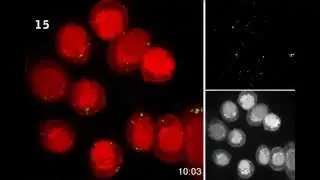 University of Pittsburgh Center for Biologic Imaging Presents: Science as Art: Cellular Terpsichore