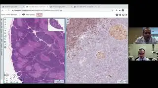 Fresh Air With the Lung Path Guys. Episode 1: Normal Thymus