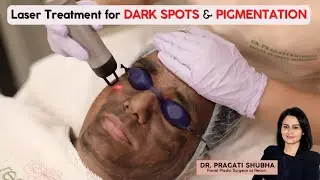 ✳️ Laser Treatment for Dark Spots & Pigmentation |✳️Carbon Laser &  Laser Toning Treatment Procedure