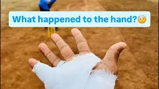 Haath Ma Shu Thayu? 🤕 | Funny Injury Story & Cricket Ground Update 🏏