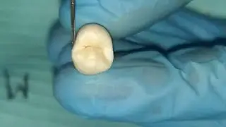 Teeth identification - part 2- أولى أسنان