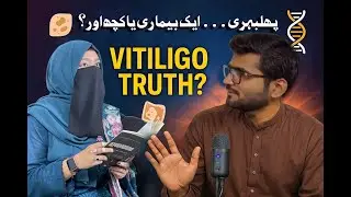 Vitiligo ki Kahani | Navaira ki Zindagi aur Struggle | HFH Podcast Ep.4