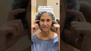 Natural Results| Facelift & Brow Lift 1 Year Post-Op| Before and After