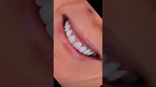 Dentist near me istanbul advice best dentist, implant İstanbul, emergency istanbul