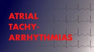 Atrial Arrhythmias (A-fib vs A-Flutter vs Focal vs Multifocal Atrial Tachycardia) - MEDZCOOL