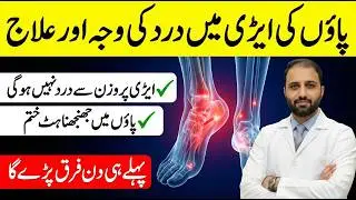 Aedi Me Dard Ka Ilaj | Heel Pain Treatment | Plantar Fasciitis | Airi Mein Dard | Paon Ka Dard