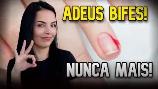Como nunca mais tirar bife da unha?