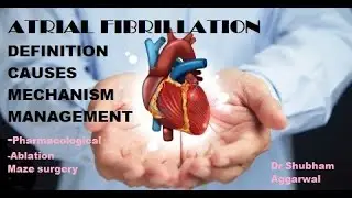 ATRIAL FIBRILLATION