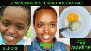 overnight vaseline and egg for a smooth skin in a week // vaseline and egg to smoothen your skin
