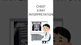 chest x-ray interpretation