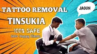 Tattoo Removal Tinsukia 100% safe