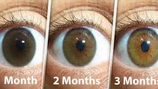 A Natural Remedy That Will Clean The Eyes Treat Cataracts And Improve Your Eyesight In Only 3 Month