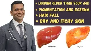Skin Signs Indicating That Your Liver Is In Trouble And Natural Ways To Treat Your Liver